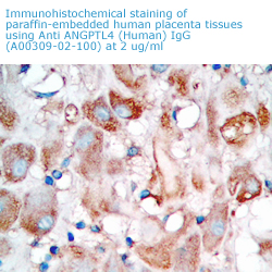 anti angptl4 antibody