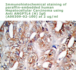 anti human angptl4 antibody for immunohistochemistry