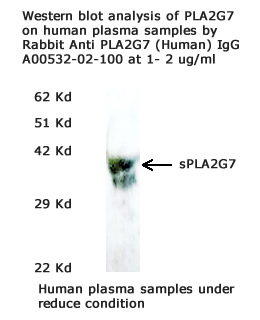  rabbit anti PLA2G7 antibody enables to detect human plasma samples on western blot. aviscera bioscience offers highly specific antibody against the secreted PLA2G7